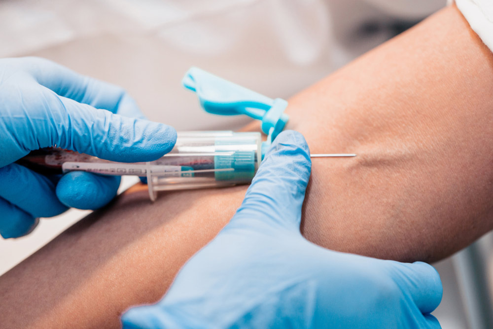 Phlebotomy in Sussex
